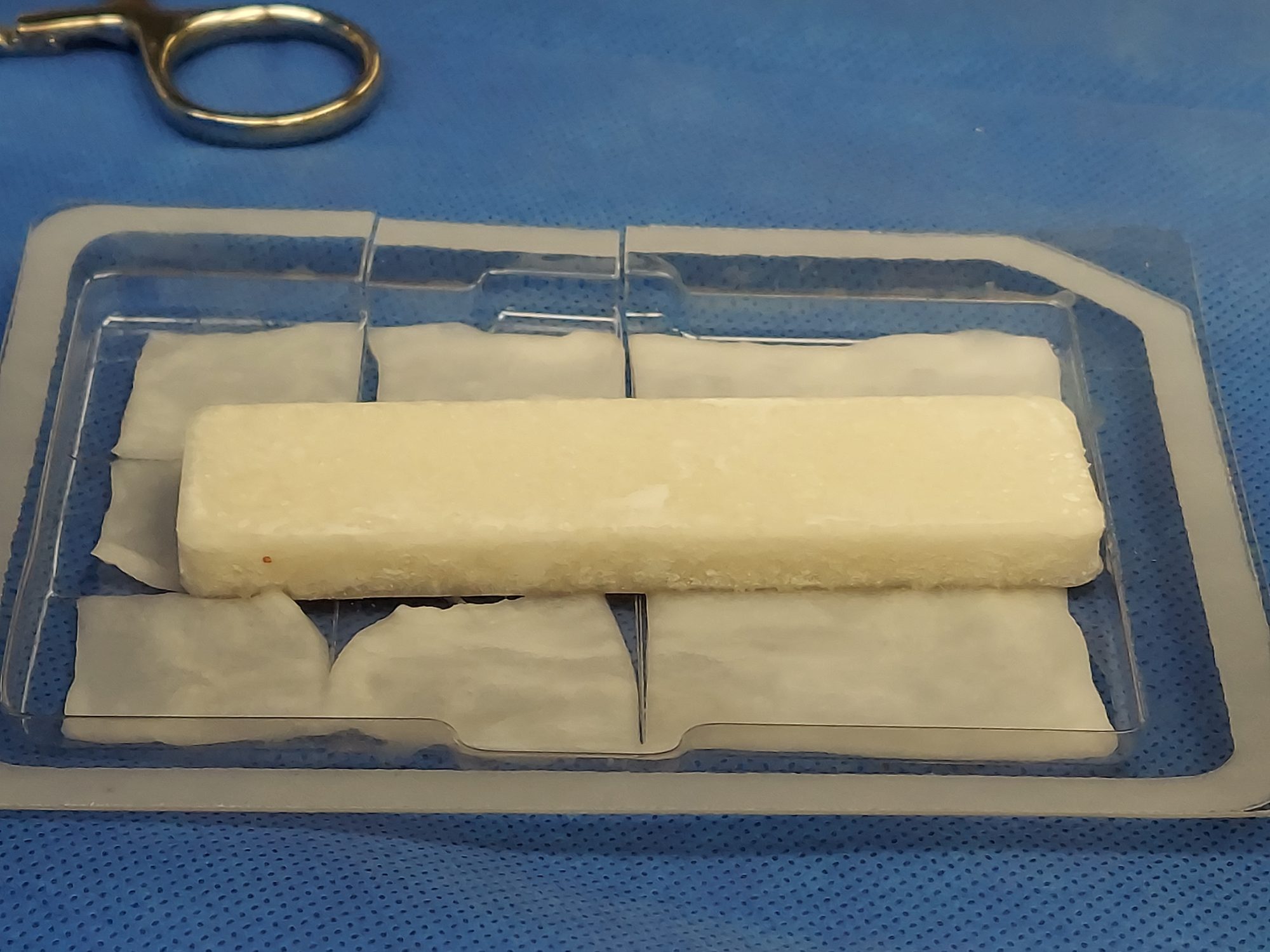 Bone graft options for spinal fusion, compared honestly